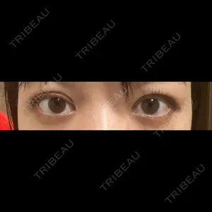 TCB東京中央美容外科 TCB東京中央美容外科 渋谷東口院口コミ