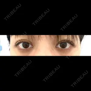TCB東京中央美容外科 TCB東京中央美容外科 渋谷東口院口コミ