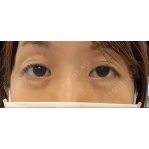 JBCジュノビューティークリニック 新宿三丁目院口コミ