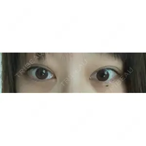 APOLLO BEAUTY CLINIC口コミ