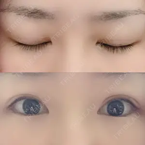 口コミ