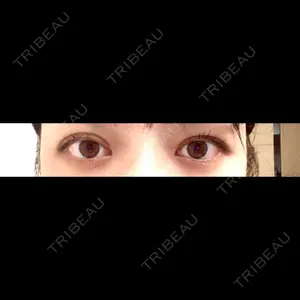 TCB東京中央美容外科 TCB東京中央美容外科 渋谷東口院口コミ