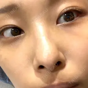 APOLLO BEAUTY CLINIC口コミ
