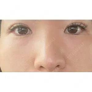 東郷美容形成外科 福岡口コミ