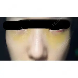 APOLLO BEAUTY CLINIC口コミ