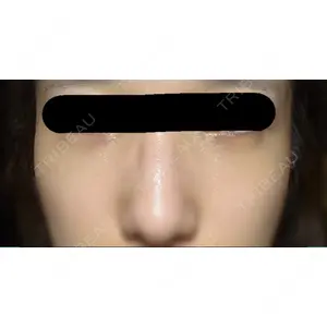 APOLLO BEAUTY CLINIC口コミ