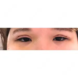 口コミ