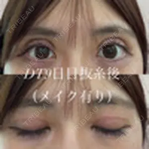 口コミ