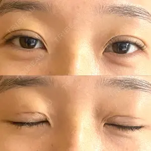東郷美容形成外科 福岡口コミ
