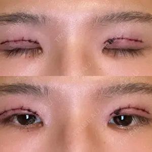 東郷美容形成外科 福岡口コミ