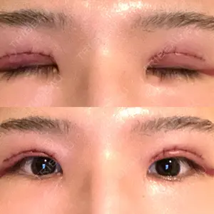 東郷美容形成外科 福岡口コミ