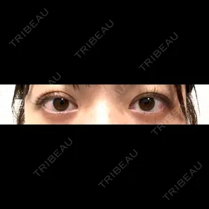 TCB東京中央美容外科 TCB東京中央美容外科 渋谷東口院口コミ