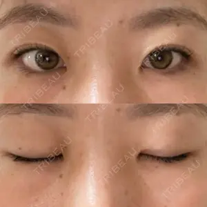 R.O.clinic口コミ