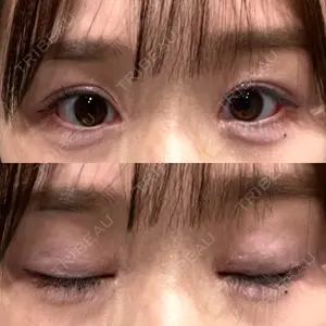 いちのせ形成外科・皮膚科 眼瞼＆フェイスクリニック口コミ