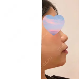 口コミ