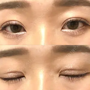 東郷美容形成外科 福岡口コミ