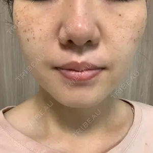 まゆりなclinic 名古屋栄口コミ