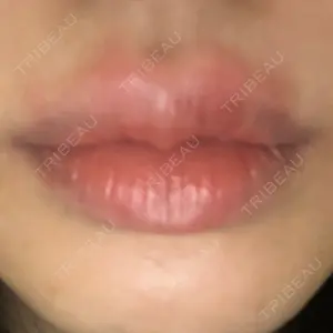 聖心美容クリニック グループ S-Laboクリニック 渋谷院口コミ