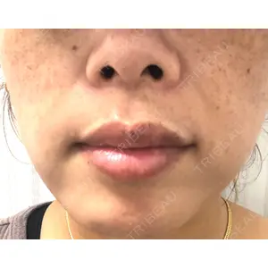 TCB東京中央美容外科 TCB東京中央美容外科 新宿三丁目院口コミ