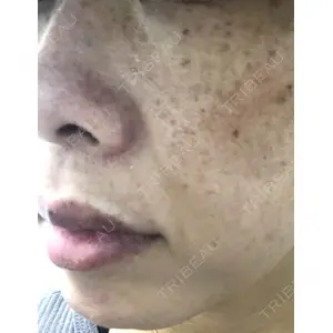 TCB東京中央美容外科 TCB東京中央美容外科 新宿三丁目院口コミ