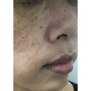 TCB東京中央美容外科 TCB東京中央美容外科 新宿三丁目院口コミ