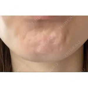 TCB東京中央美容外科 TCB東京中央美容外科 千葉駅前院口コミ