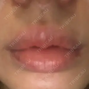 聖心美容クリニック グループ S-Laboクリニック 渋谷院口コミ