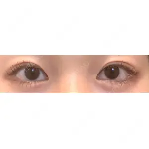 口コミ