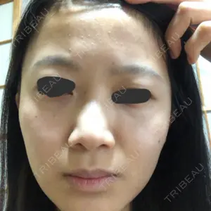 赤坂プレミアクリニック口コミ