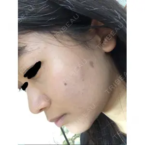 赤坂プレミアクリニック口コミ