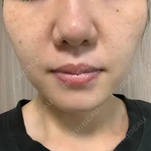 まゆりなclinic 名古屋栄口コミ