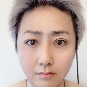 東郷美容形成外科 福岡口コミ