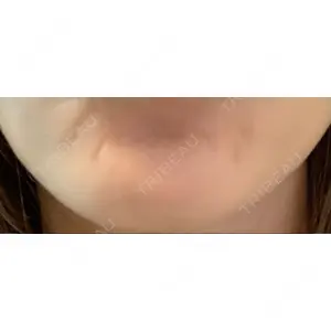 TCB東京中央美容外科 TCB東京中央美容外科 千葉駅前院口コミ