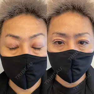 東郷美容形成外科 福岡口コミ