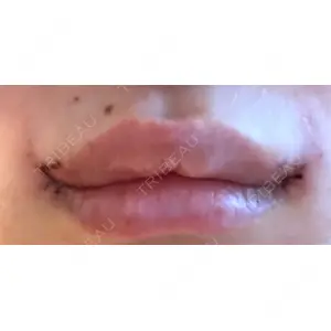 くさのたろうクリニック口コミ