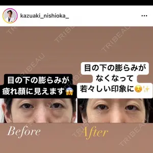JBCジュノビューティークリニック 新宿三丁目院口コミ