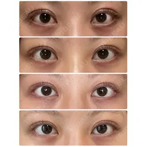 東郷美容形成外科 福岡口コミ