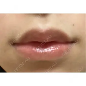 B-LINE CLINIC B-LINE CLINIC 池袋院口コミ