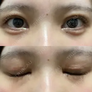 口コミ