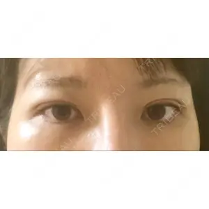 湘南美容クリニック 湘南美容クリニック 池袋西口院口コミ