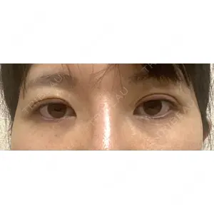 湘南美容クリニック 湘南美容クリニック 池袋西口院口コミ