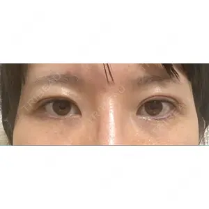 湘南美容クリニック 湘南美容クリニック 池袋西口院口コミ