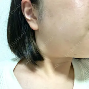 銀座ゼロクリニック口コミ