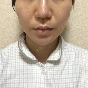 湘南美容クリニック 湘南美容クリニック 秋葉原院口コミ