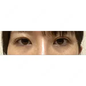 湘南美容クリニック 湘南美容クリニック 池袋西口院口コミ