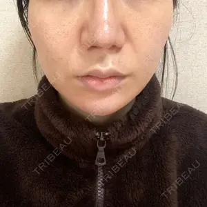 湘南美容クリニック 湘南美容クリニック 秋葉原院口コミ