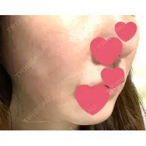 銀座ゼロクリニック口コミ