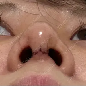 口コミ