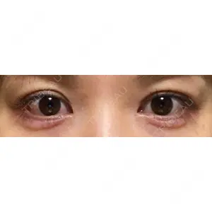 口コミ