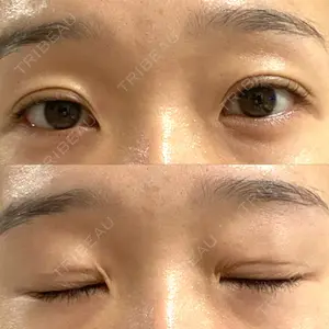 東郷美容形成外科 福岡口コミ